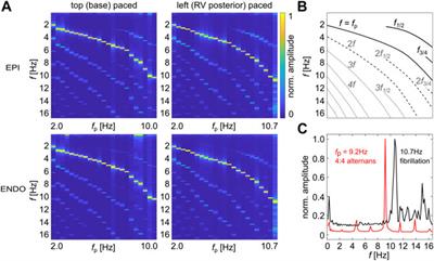 Optical Ultrastructure of Large Mammalian Hearts Recovers Discordant Alternans by In Silico Data Assimilation